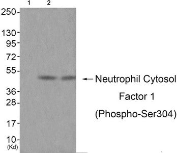 Phospho-NCF1 (Ser304) Antibody