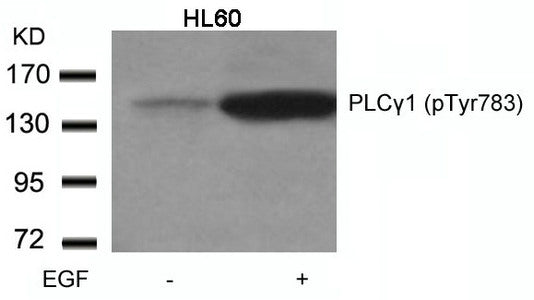 Phospho-PLCG1 (Tyr783) Antibody