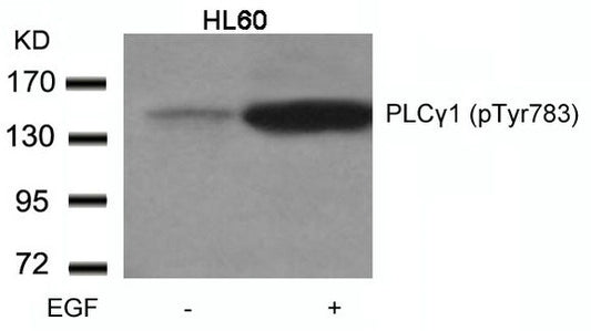 Phospho-PLCG1 (Tyr783) Antibody
