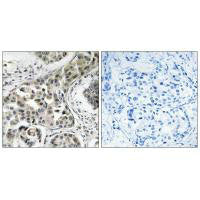 USP6NL Antibody