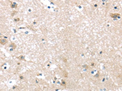 ITPA Antibody