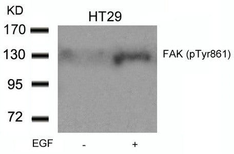Phospho-PTK2 (Tyr861) Antibody
