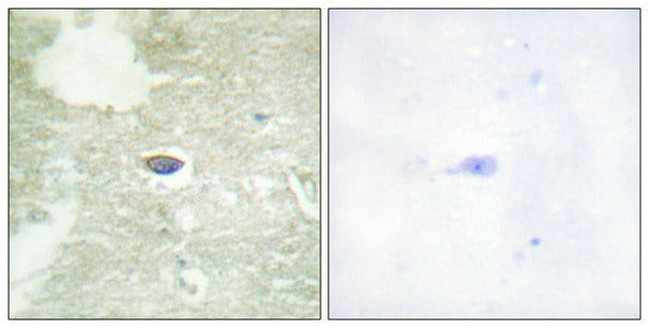Phospho-TGFBR2 (Ser225/250) Antibody