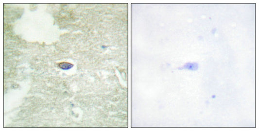 Phospho-TGFBR2 (Ser225/250) Antibody