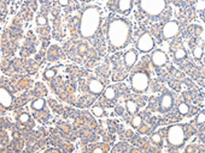 VPS54 Antibody
