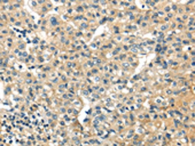 SESN3 Antibody