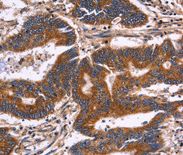 KIR2DL3 Antibody