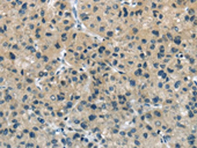 TGM5 Antibody