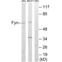 FYN (Ab-530) Antibody