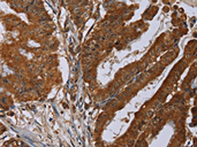 SLC22A2 Antibody