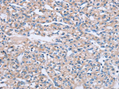 TF Antibody