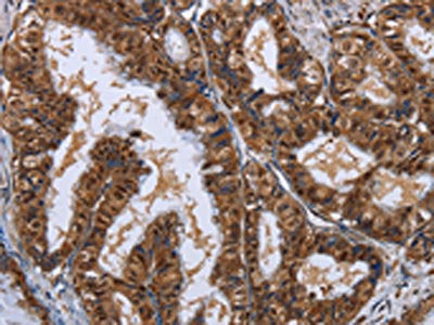 LTA4H Antibody