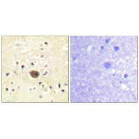 RASGRF1 Antibody