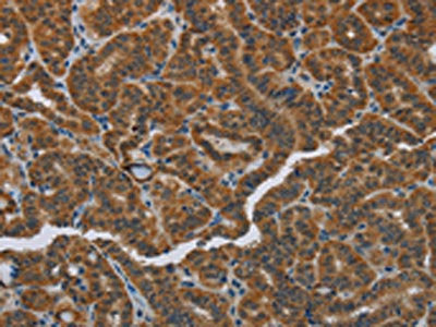 HSD3B7 Antibody