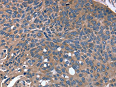 RGS4 Antibody