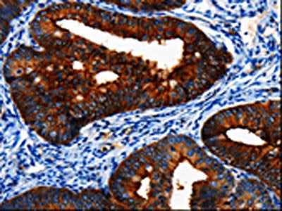 BIRC6 Antibody