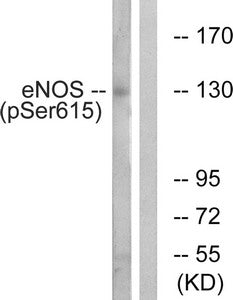 Phospho-NOS3 (Ser615) Antibody