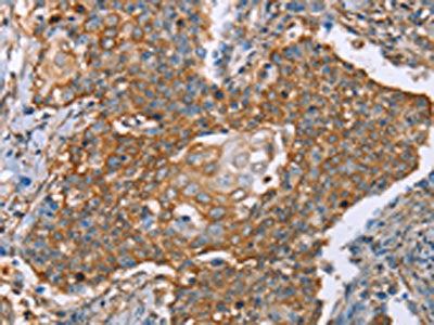 PAICS Antibody