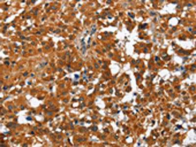 PAK2 Antibody