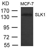 SLK Antibody