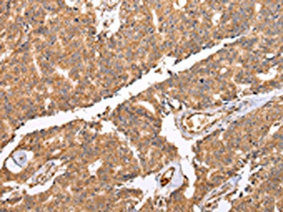 UQCRC2 Antibody