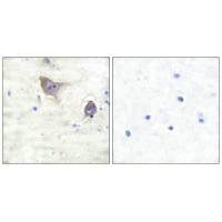 SNCB Antibody