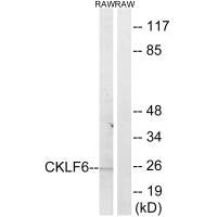 CMTM6 Antibody