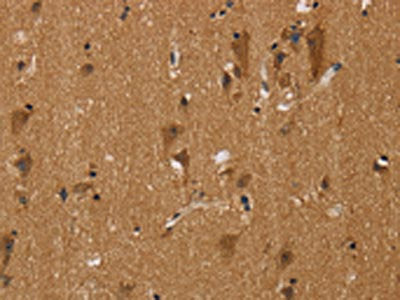 NGFRAP1 Antibody