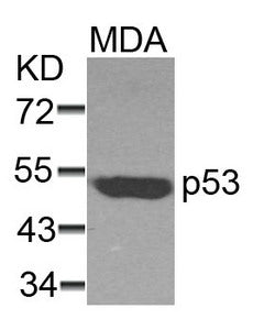 TP53 (Ab-37) Antibody