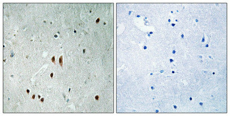 Phospho-CNOT2 (Ser101) Antibody