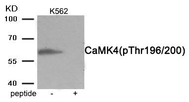 Phospho-CAMK4 (Thr196/200) Antibody