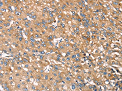 RNASET2 Antibody
