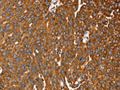 RASSF3 Antibody