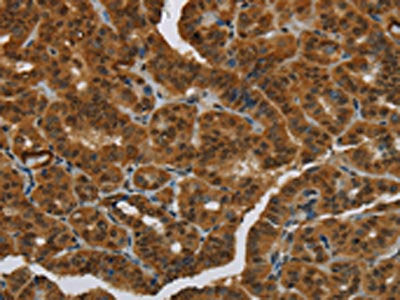 MRE11A Antibody