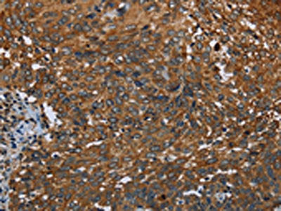 IL2RG Antibody