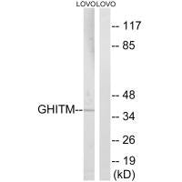 GHITM Antibody
