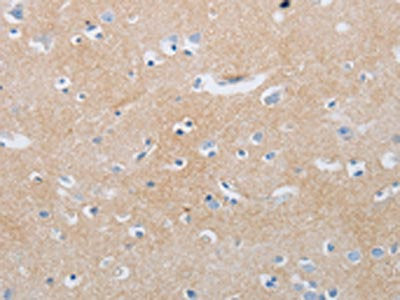 MME Antibody