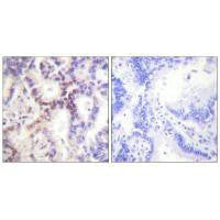 CDKN2B Antibody
