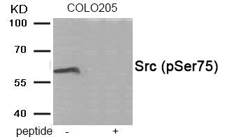 Phospho-SRC (Ser75) Antibody