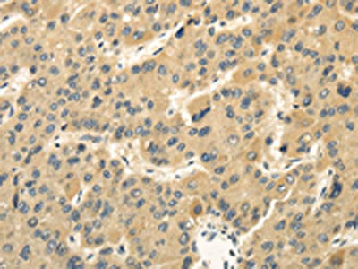 MED16 Antibody