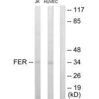 FER Antibody