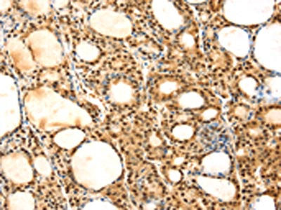 SAMD3 Antibody