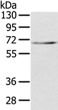 TBL1X Antibody