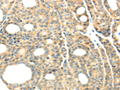 TTBK2 Antibody