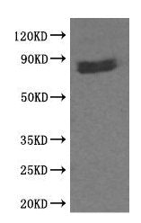 CTNNB1 Antibody