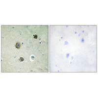 CDK5 (Ab-15) Antibody