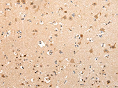 VPS16 Antibody