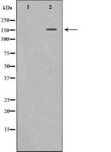 MET Antibody