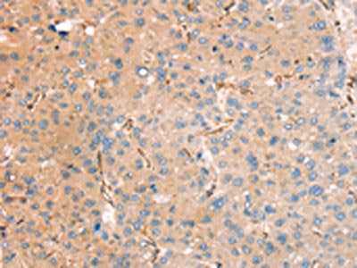 RASAL2 Antibody