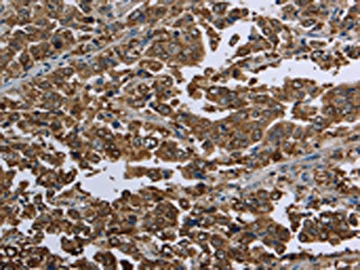 HSPA9 Antibody